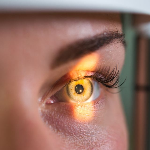 Vision Therapy in Tucson
